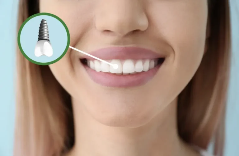 Woman with Dental Implant